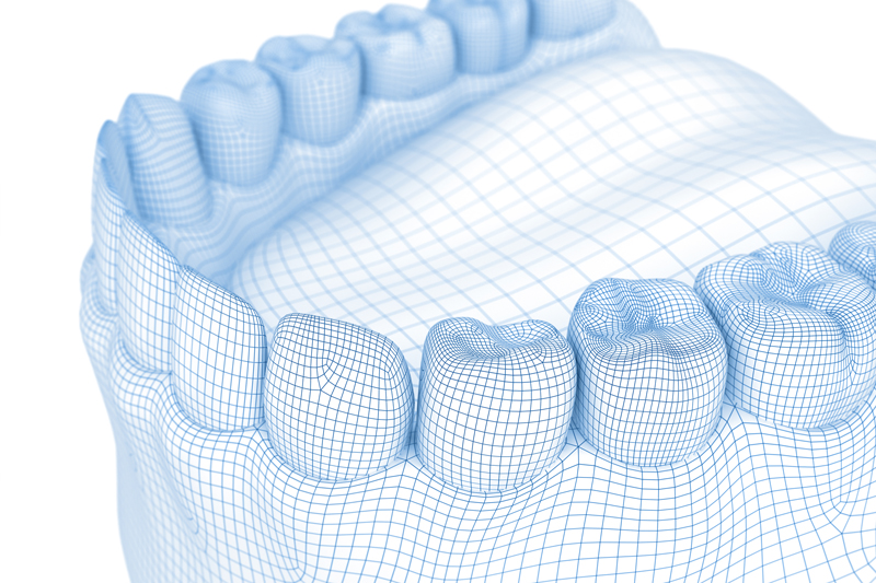 3 D-Scan für schmerzlose Abdrücke – Zahnarzt Dr. K-H Königshofer -Mund-, Kiefer- und Gesichtschirurgie