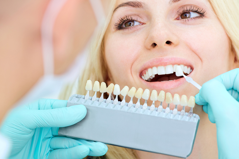 Prophylaxe und Ästhetik – Zahnarzt Dr. K-H Königshofer -Mund-, Kiefer- und Gesichtschirurgie